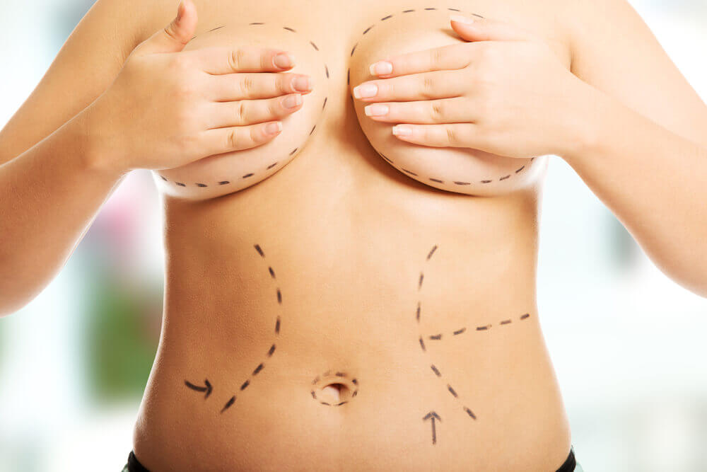 A diferença entre mamoplastia redutora e mastopexia