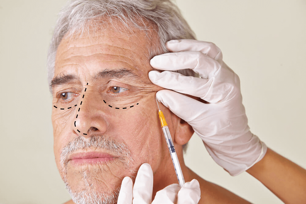 Rinoplastia senil: Plástica de nariz para idosos – Entenda