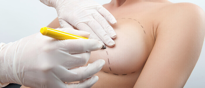 Como se preparar para a mamoplastia de aumento?