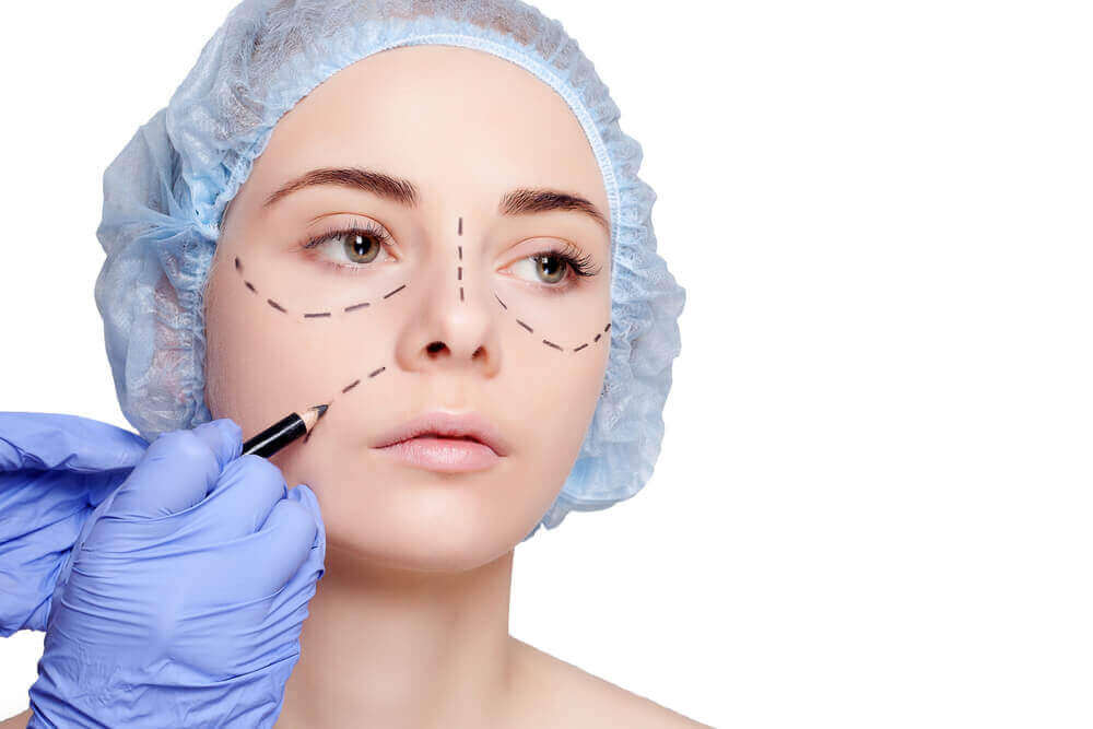 Como é o procedimento de Ritidoplastia, ou lifting facial?