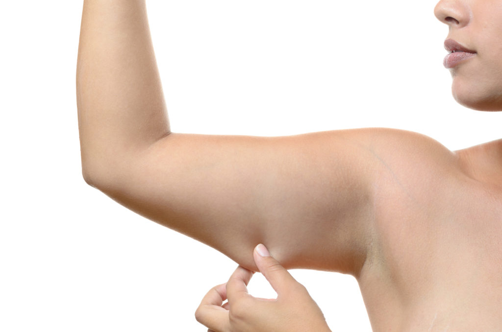 Young woman pinching the skin on her upper arm
