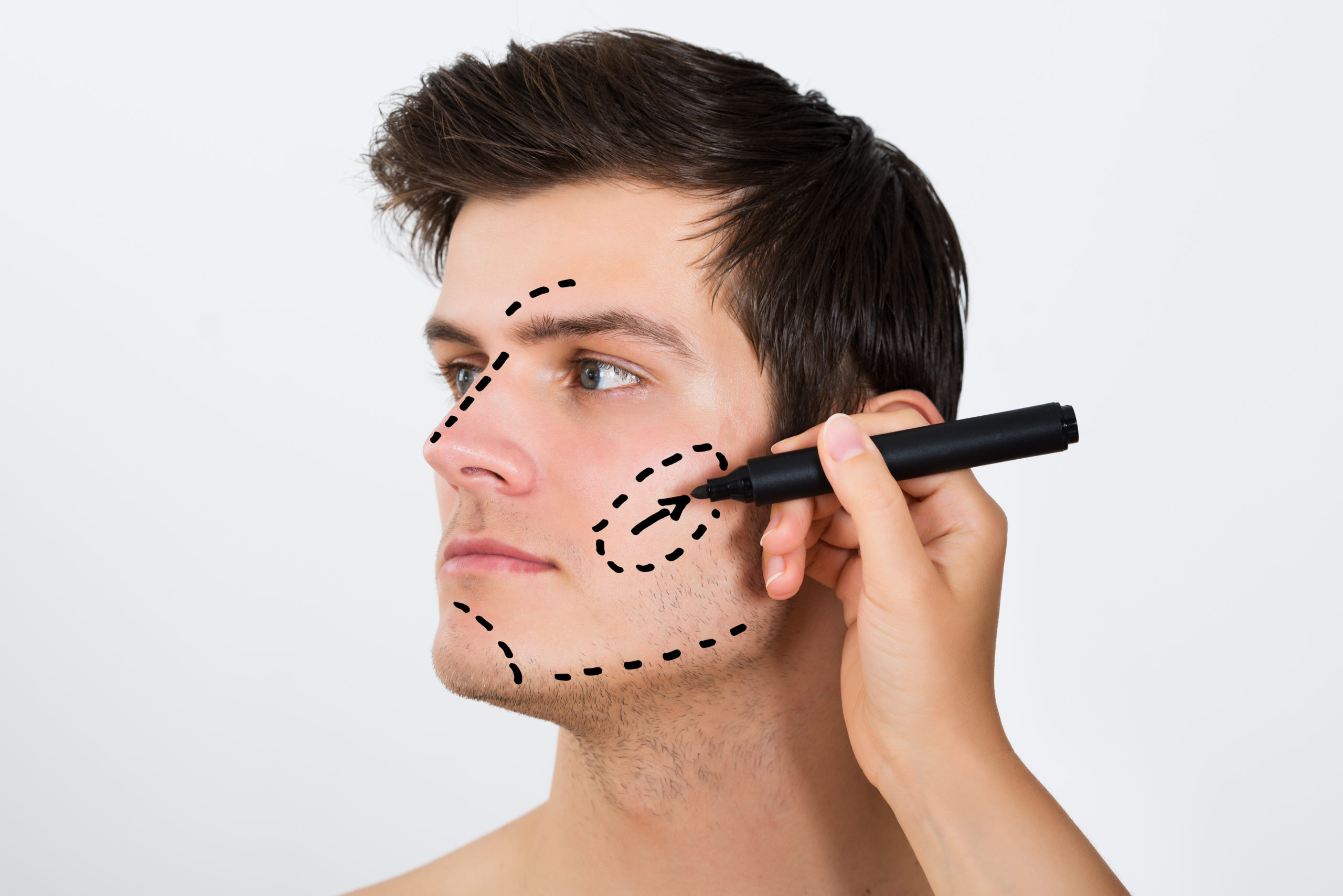 Harmonização Facial Masculina: conheça os diferenciais do procedimento