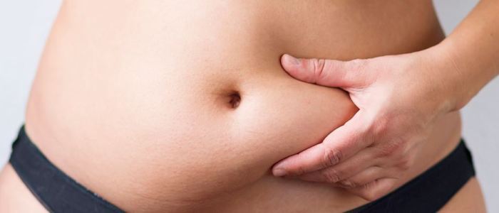 Descubra a Abdominoplastia pós-gravidez