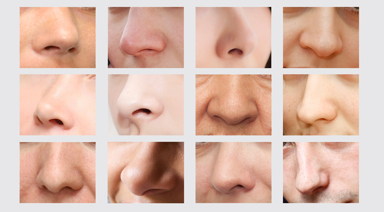 Tipos de pele do nariz e suas implicações para o resultado da rinoplastia