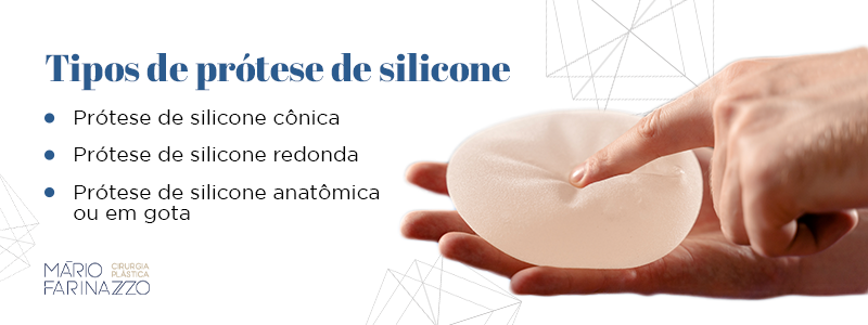 Tipos de prótose de siliconePrótose de silicone cônica
Prótose de silicone redonda
Prótose de silicone anatômica ou em gota