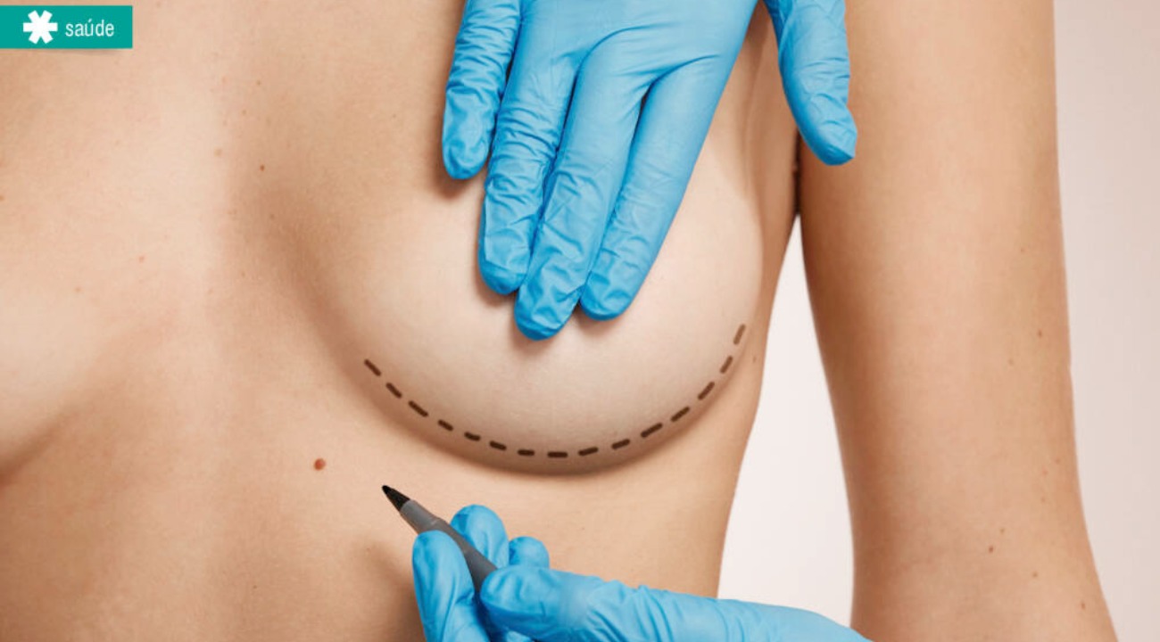 3 mitos sobre procedimentos estéticos e cirurgia plástica