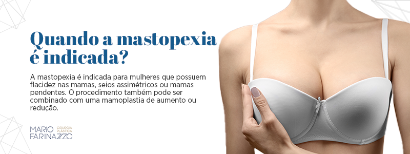 Quando a mastopexia é indicada? A mastopexia é indicada para mulheres que possuem flacidez nas mamas, seios assimétricos ou mamas pendentes. O procedimento também pode ser combinado com uma mamoplastia de aumento ou redução.