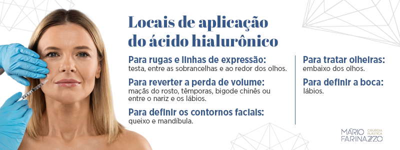 Locais de aplicação do ácido hialurônico:
Para rugas e linhas de expressão: testa, entre as sobrancelhas e ao redor dos olhos.
Para reverter a perda de volume: maçãs do rosto, têmporas, bigode chinês ou entre o nariz e os lábios.
Para definir os contornos faciais: queixo e mandíbula.
Para tratar olheiras: embaixo dos olhos.
Para definir a boca: lábios.