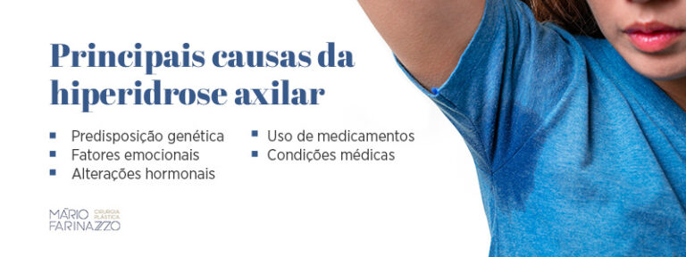 Suor excessivo nas axilas: como acabar com esse problema?