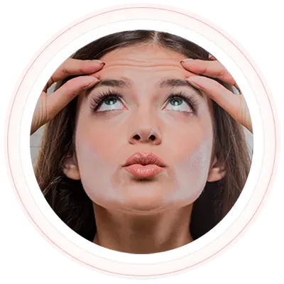 Botox® – Toxina Botulínica