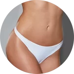Abdominoplastia