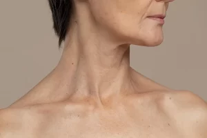 Deep neck Lift